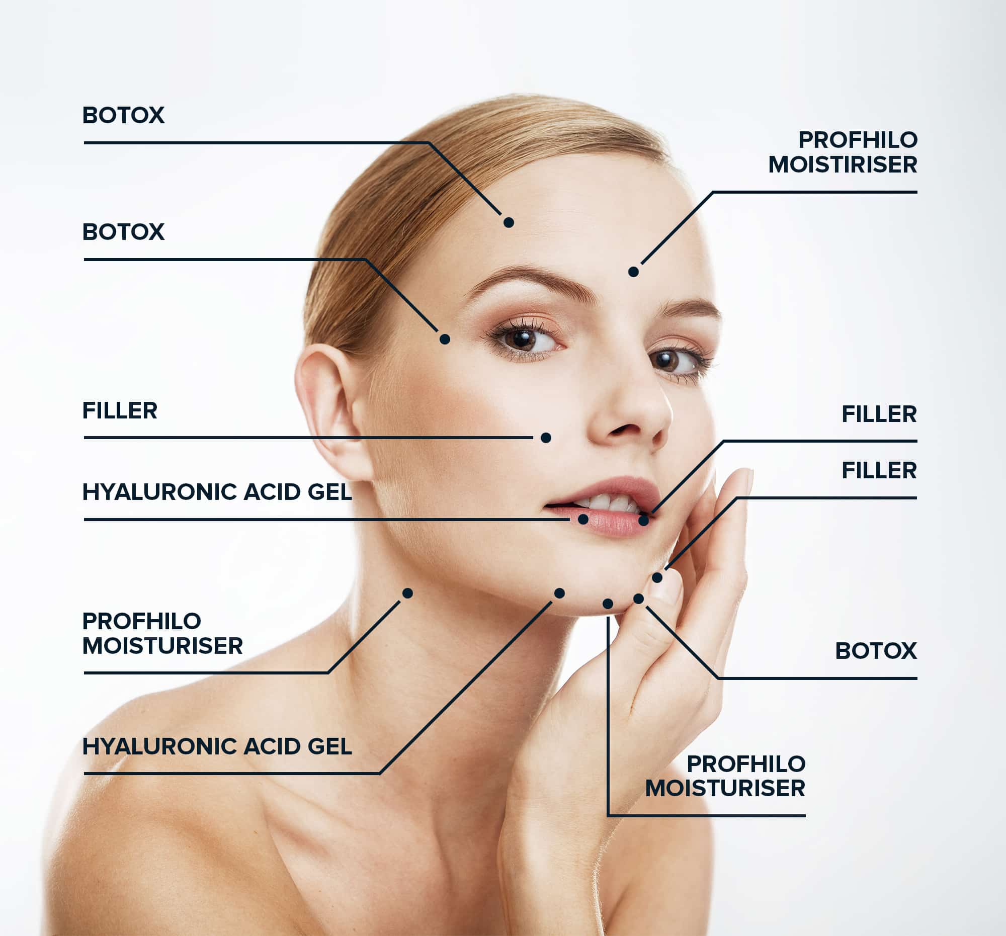 علاج بروفايلو